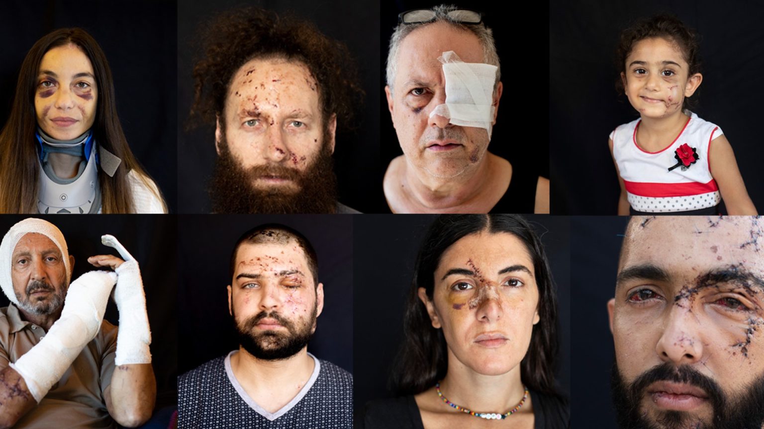 Las cicatrices de Líbano: los rostros de la tragedia de Beirut