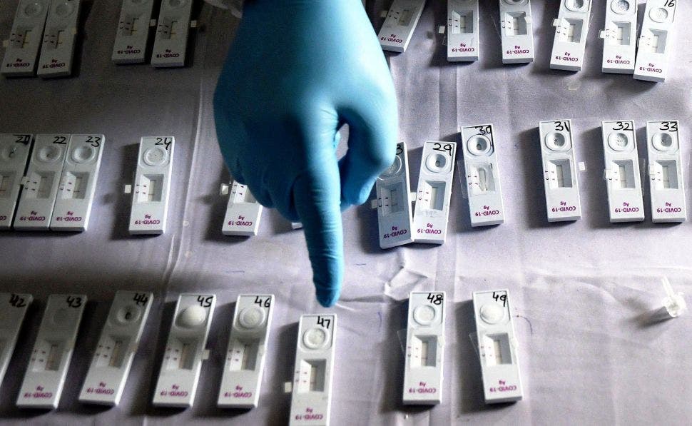 Sanidad compra 5 millones de test de antígenos para reserva frente al COVID