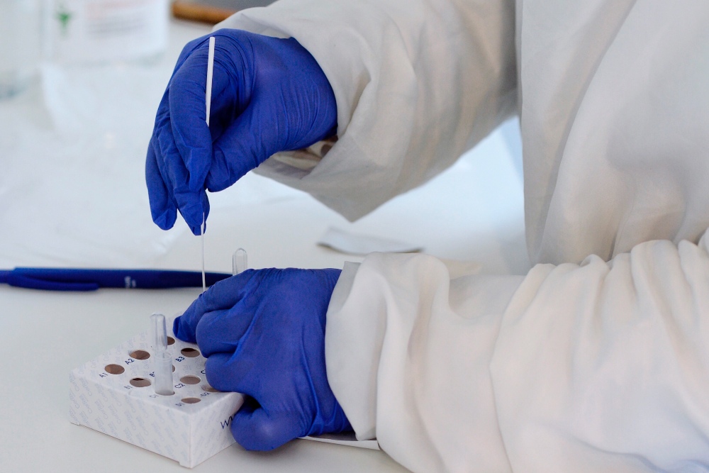 Galicia realizará un test que detecta la gripe y el coronavirus en la misma muestra