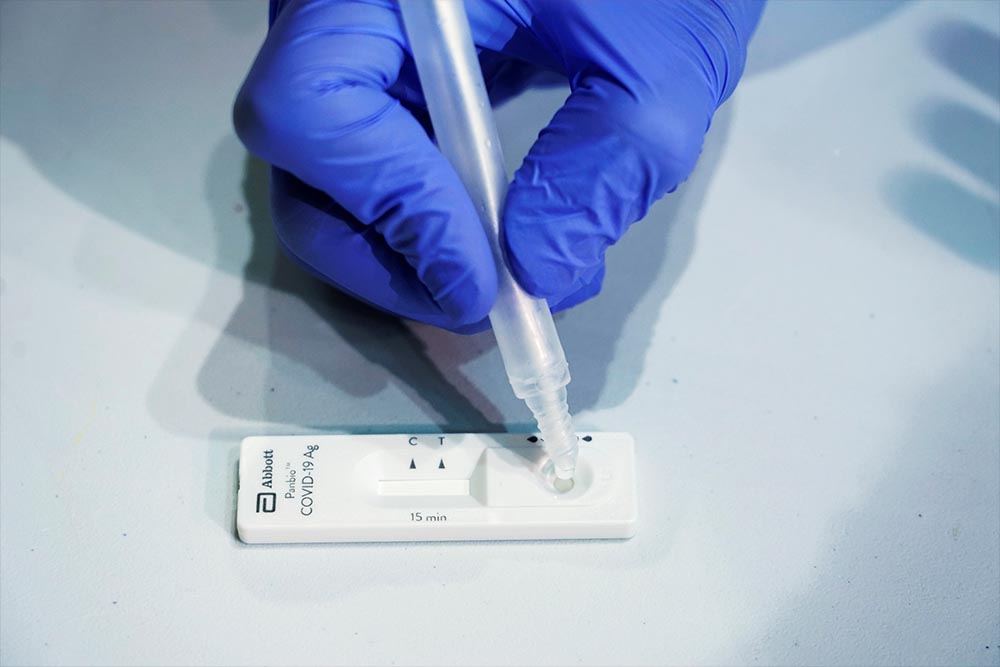 Comienza la distribución de test rápidos de anticuerpos en farmacias