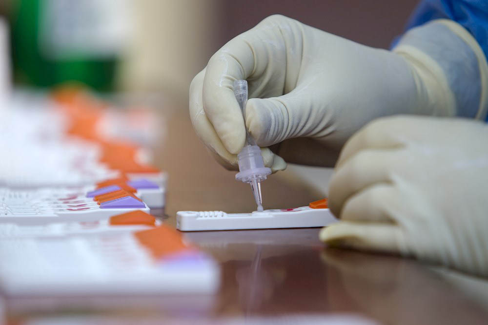 La Sociedad Española de Enfermedades Infecciosas advierte de la baja fiabilidad de los test de anticuerpos