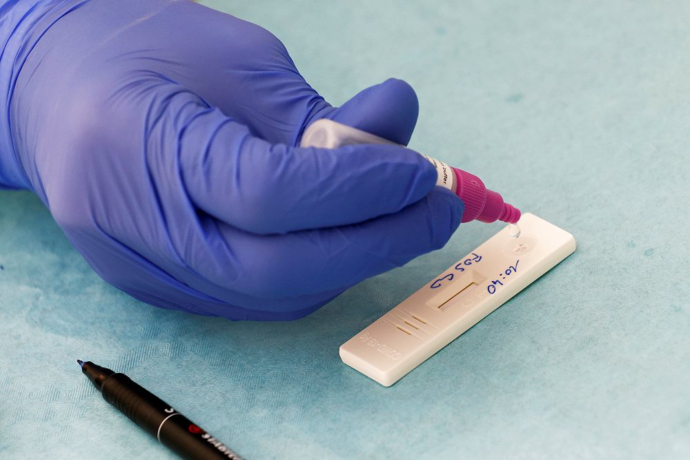 Italia detecta un contagio de coronavirus con la nueva variante de Reino Unido