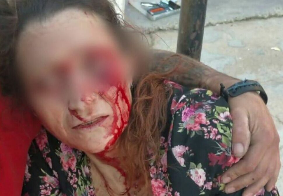 Unos okupas golpean a una madre que defendía a su hijo en Alicante