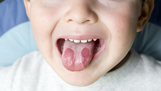Confirman nuevos síntomas del Covid: alteraciones en la lengua, manos y pies