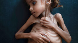 Yemen: un país hambriento