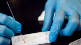 La prueba cutánea que sirve para detectar el coronavirus