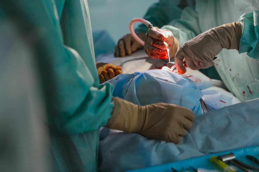 España, excelencia en donación y trasplante de órganos a pesar de la Covid 2