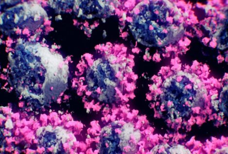 La acumulación de virus en los pulmones se convierte en la principal causa de muerte por COVID-19