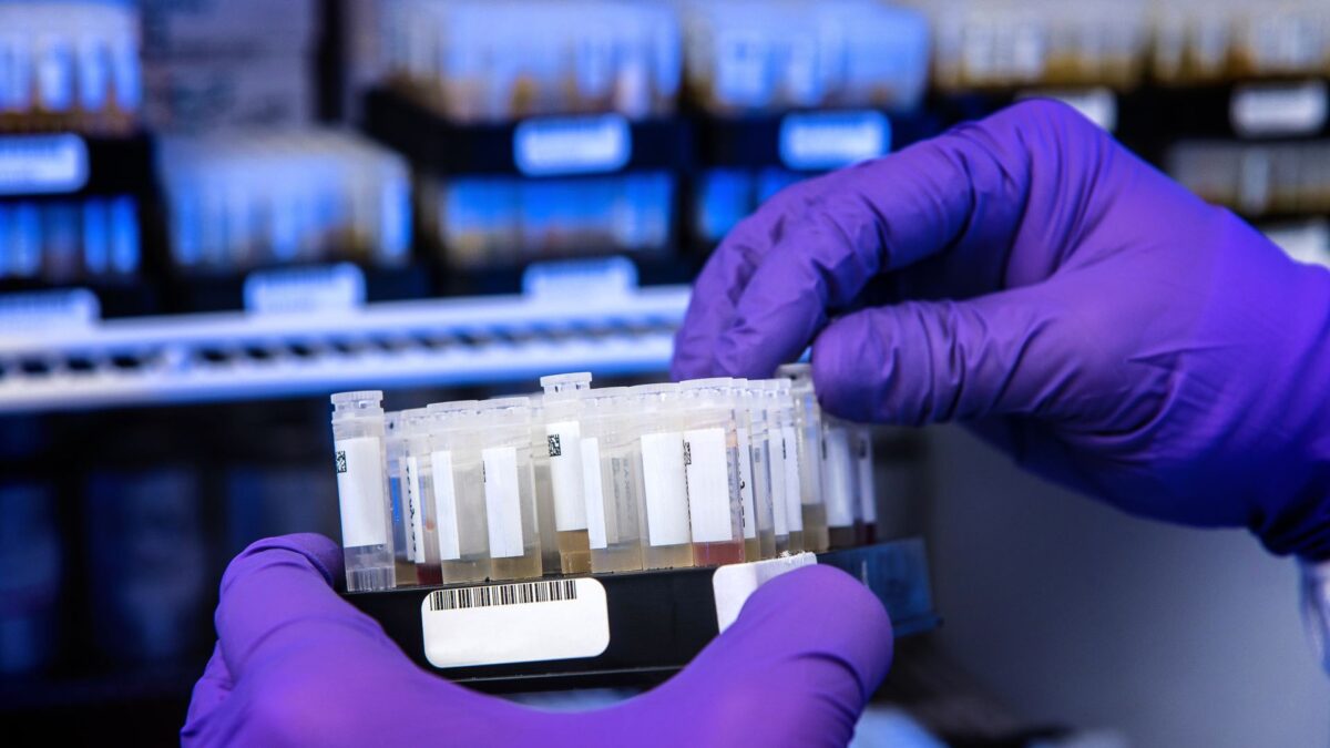 COVID-19: por qué no tiene sentido hacerse test de anticuerpos para comprobar quién está ‘de verdad’ inmunizado