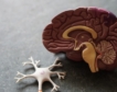 Un fármaco contra el Alzheimer arroja datos «positivos»: rebaja un 27% el deterioro cognitivo