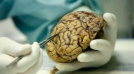 Demuestran la existencia de células madre en el hipocampo del cerebro humano