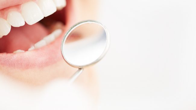 Las claves para asegurar el éxito de un blanqueamiento dental duradero