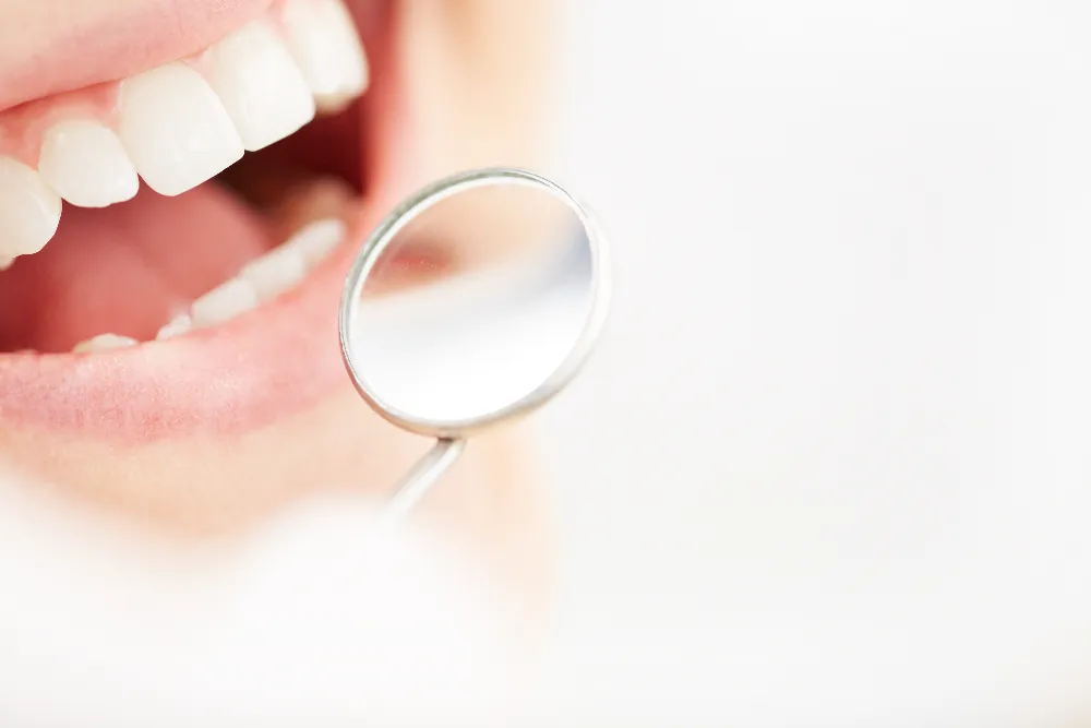 Las claves para asegurar el éxito de un blanqueamiento dental duradero