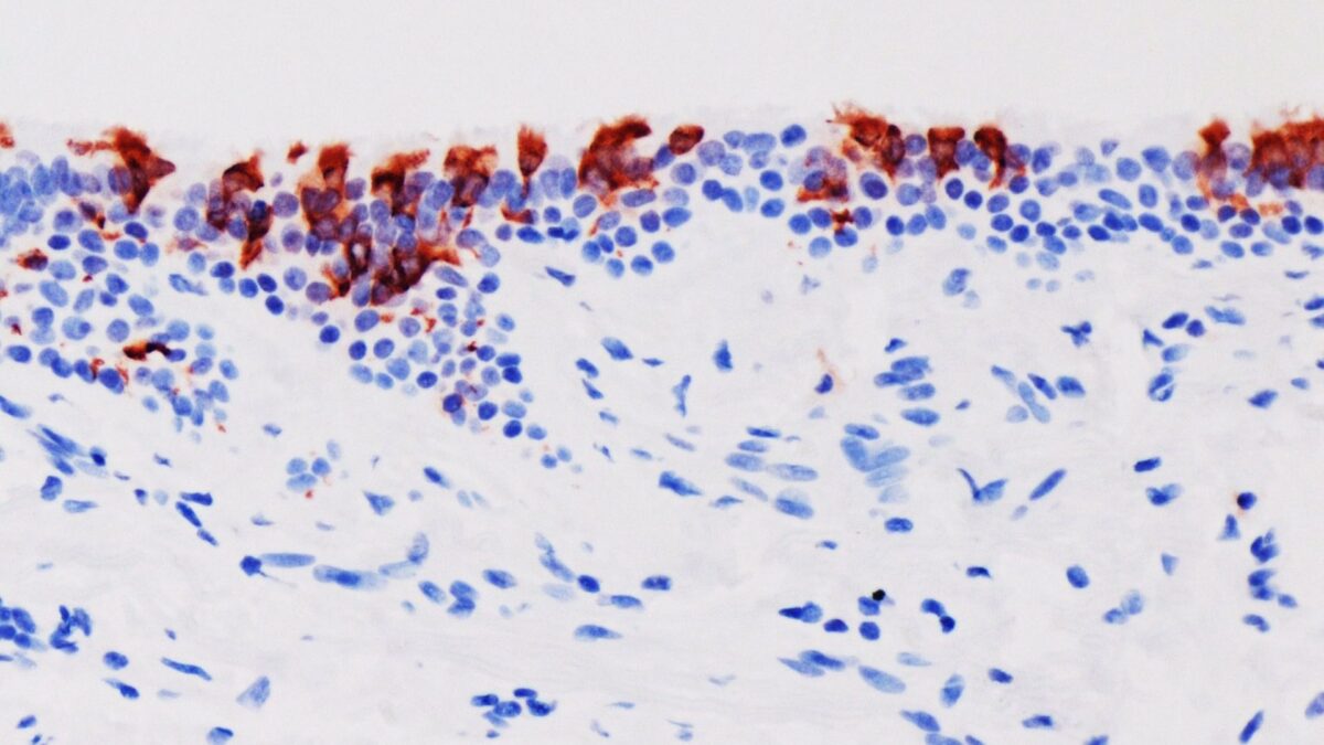 Un estudio apunta que ómicron infecta «más rápido y mejor» que Delta, pero con menor gravedad en el pulmón