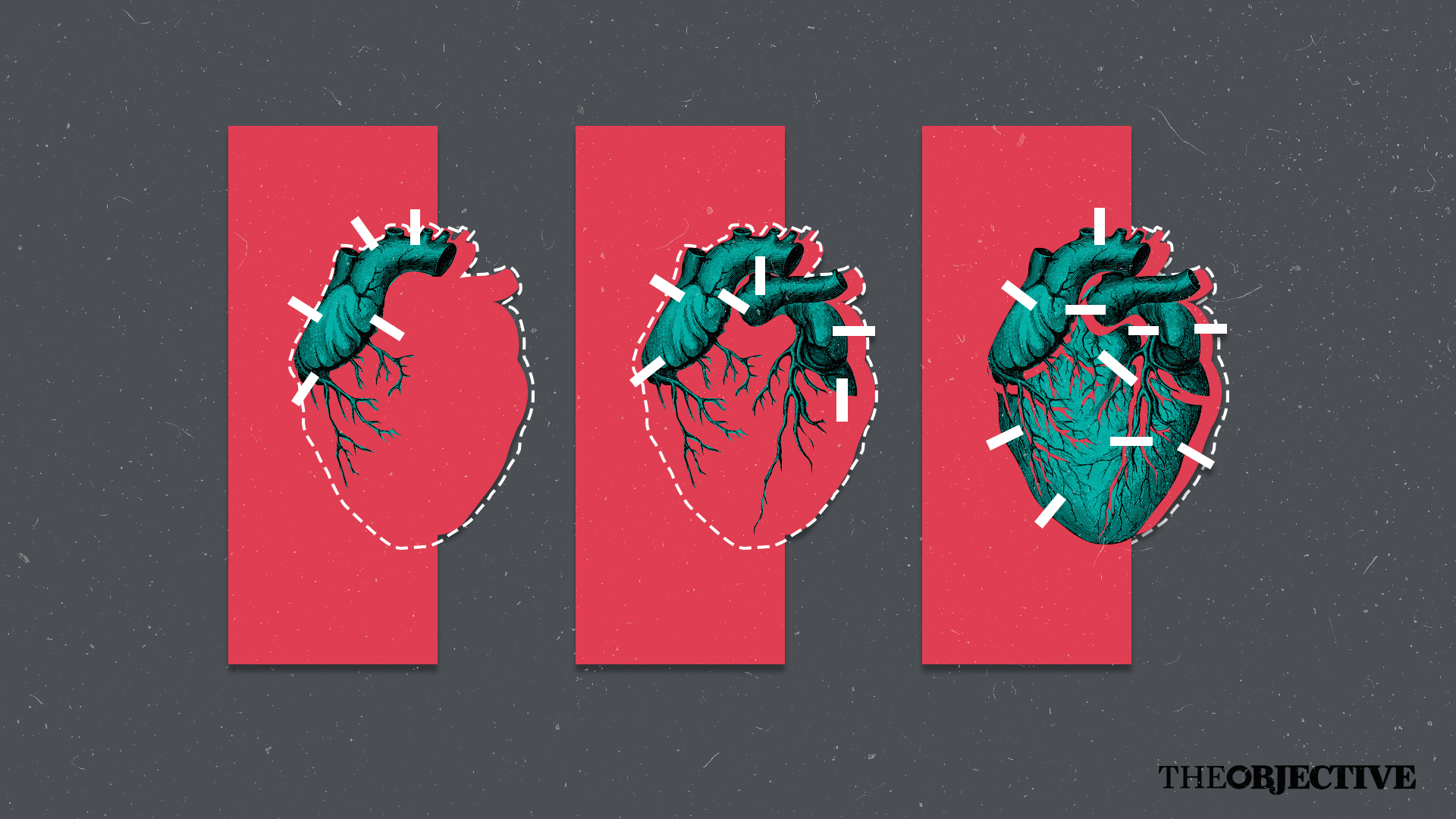 Miocarditis, la secuela del covid que la tecnología ha permitido conocer mejor