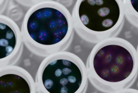Un biomarcador 'made in Spain' para tratar de forma eficaz los cánceres más graves