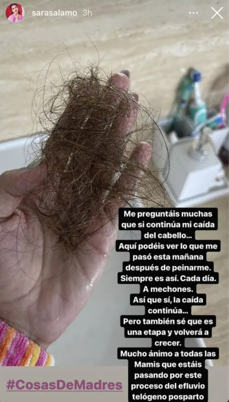 La intérprete canaria no ha podido ser más gráfica en sus redes sociales mostrando los estragos de la caída del cabello (@sarasalamo)