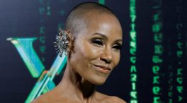 Jada Pinkett, la mujer de Will Smith, le planta cara a la alopecia femenina