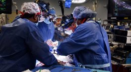 Trasplantan por primera vez en la historia con éxito un corazón de cerdo a un hombre