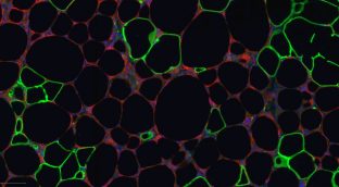 Descubren una proteína que favorece la obesidad provocada por nuestra dieta