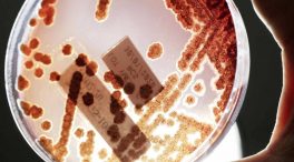 Las infecciones por bacterias multirresistentes causan más muertes que el sida o la malaria