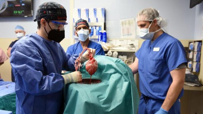 Cirugía histórica: trasplantan con éxito un corazón de cerdo a un hombre en EE.UU.