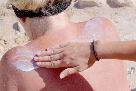 ¿Será el cáncer de piel la próxima gran epidemia?
