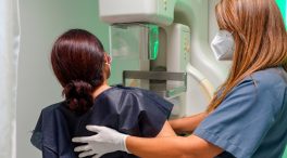 Un estudio de Vall d'Hebron demuestra que el fármaco Omomyc detiene la metástasis del cáncer de mama