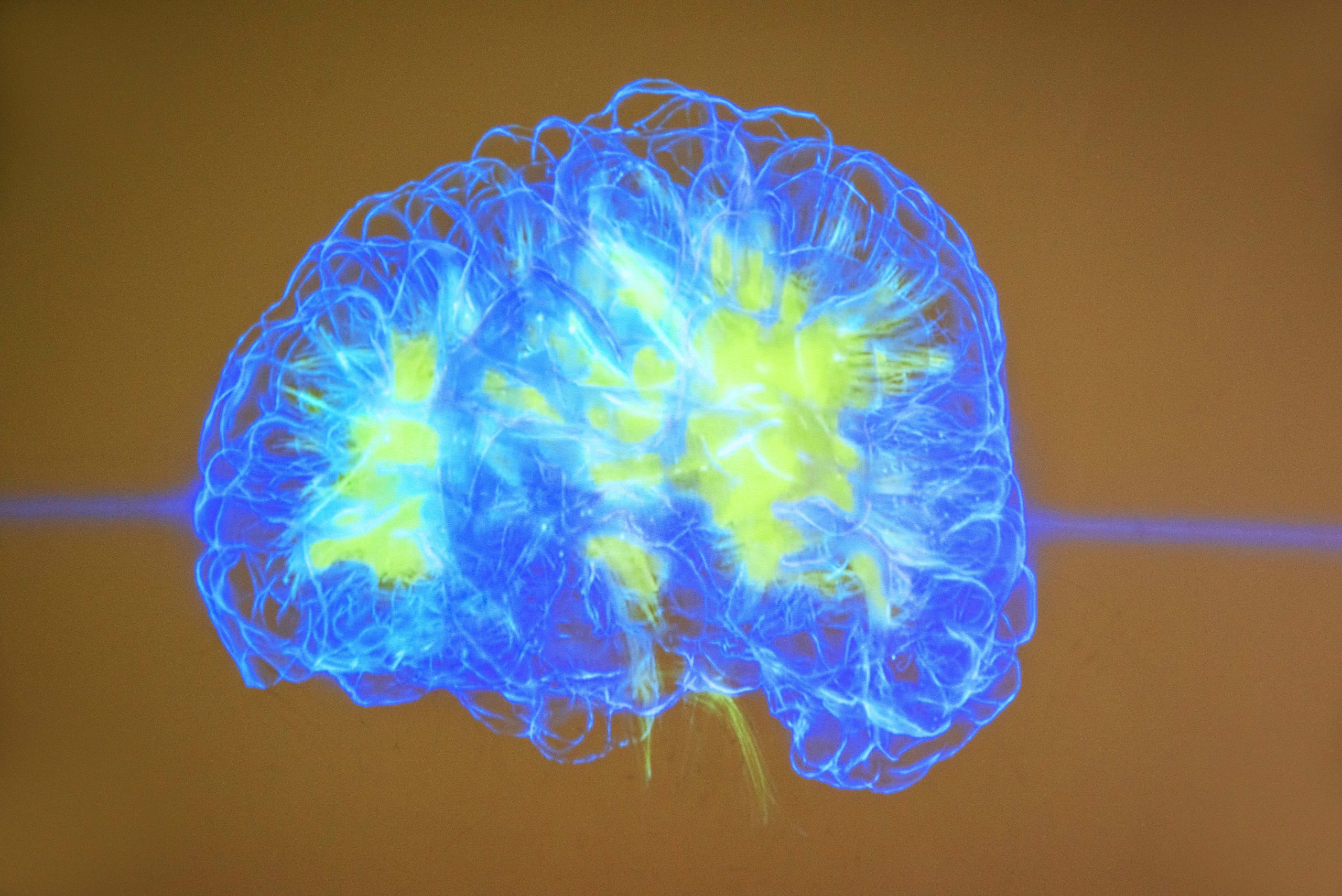 El gen que hizo especial nuestro cerebro