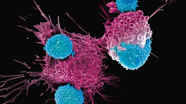 Un tratamiento experimental con células CAR-T logró remitir una década y curar la leucemia de dos pacientes
