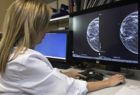 Unas alteraciones de proteínas ayudan a identificar el cáncer de mama 2 años antes de su diagnóstico