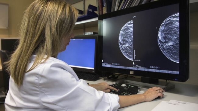 Unas alteraciones de proteínas ayudan a identificar el cáncer de mama 2 años antes de su diagnóstico