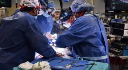 Muere el primer paciente que recibió un trasplante de un corazón de cerdo dos meses después de la operación