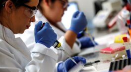 Descubren una causa genética del lupus en el genoma de una niña española