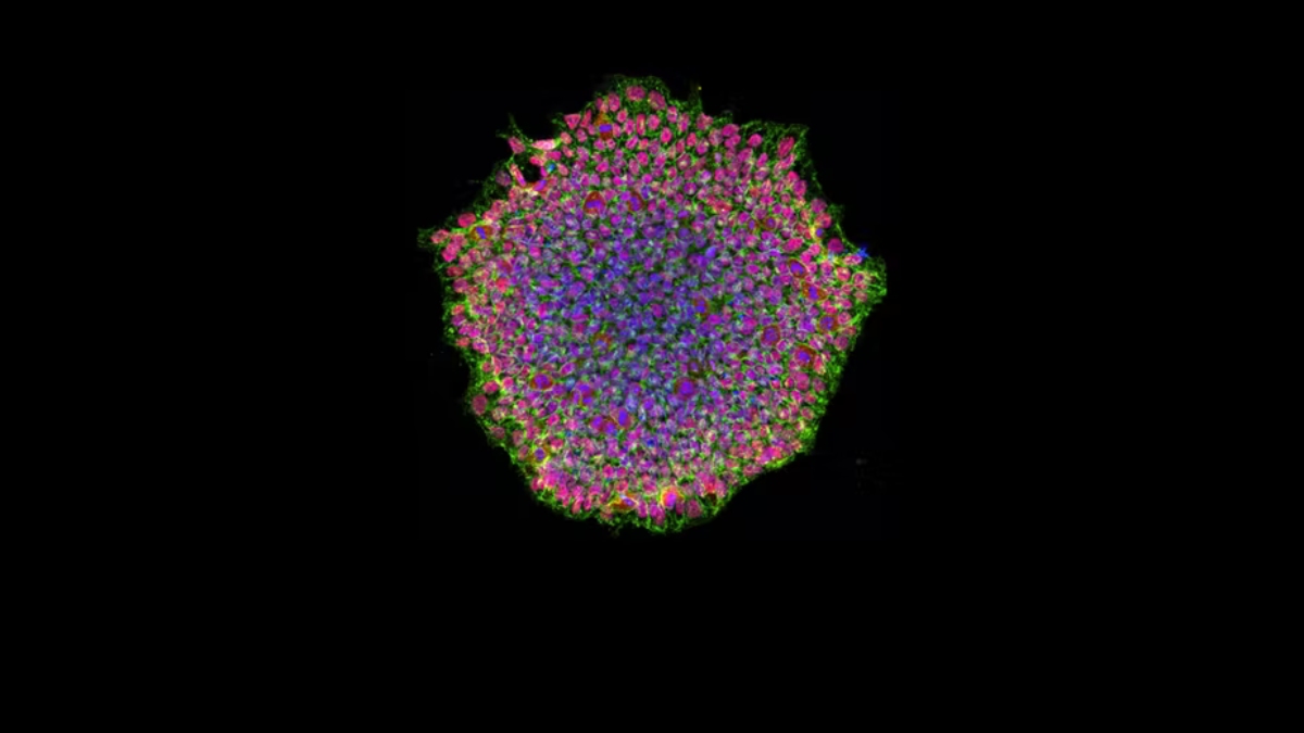 Los organoides: órganos humanos en miniatura para estudiar enfermedades