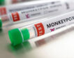 Reino Unido recomienda un aislamiento de 21 días en caso de riesgo de la viruela del mono