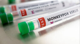 Reino Unido recomienda un aislamiento de 21 días en caso de riesgo de la viruela del mono