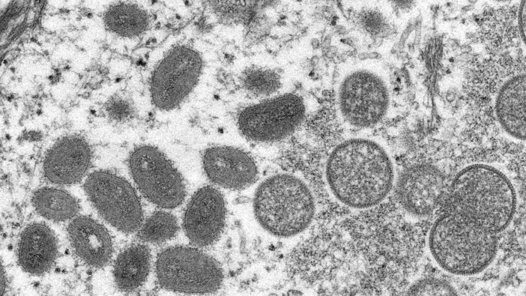 La viruela símica se detectó por primera vez en humanos en 1970 en la República Democrática del Congo. 