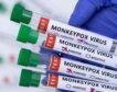 Investigadores españoles obtienen la secuencia completa del virus de la viruela del mono