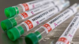 Europa alerta del riesgo alto de viruela del mono para personas «con varias parejas sexuales»