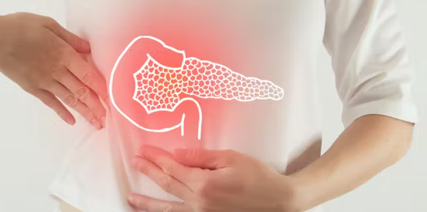Así se halló el nuevo biomarcador para detectar de forma precoz el cáncer de páncreas