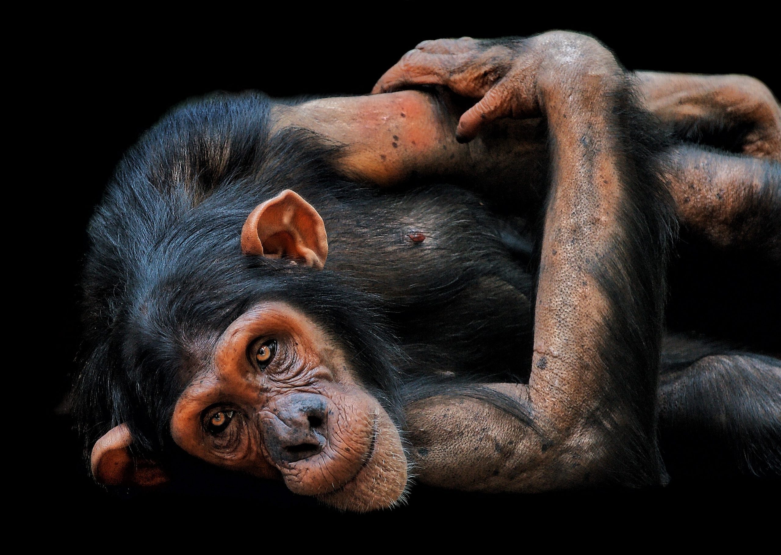 La OMS cambiará el nombre a la viruela del mono para «evitar que sea estigmatizante»