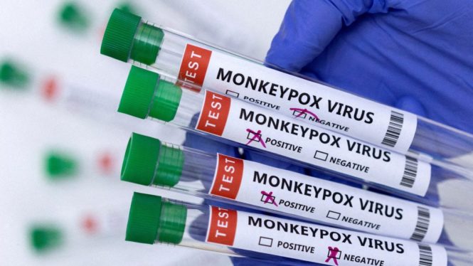 Sanidad confirma la primera muerte por viruela del mono en España