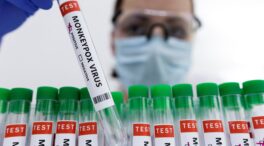La OMS descarta que la viruela del mono sea una emergencia sanitaria internacional