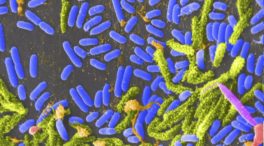 El Ministerio de Sanidad desmiente el caso de cólera detectado en Toledo: es gastroenteritis
