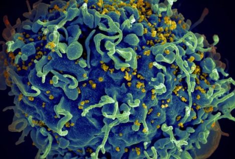 Una paciente de Barcelona lleva quince años controlando el VIH sin tomar medicamentos