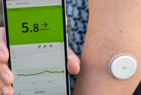 Monitores de glucosa: la nueva moda que triunfa entre los que aún no tienen diabetes