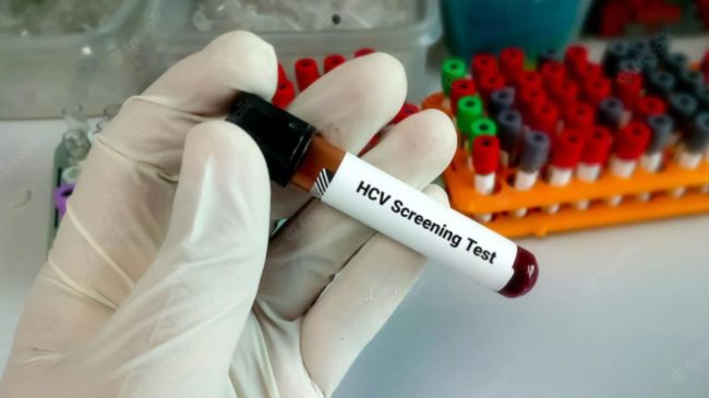 Expertos destacan las estrategias de cribado oportunista para facilitar el objetivo de eliminación de la hepatitis C en España