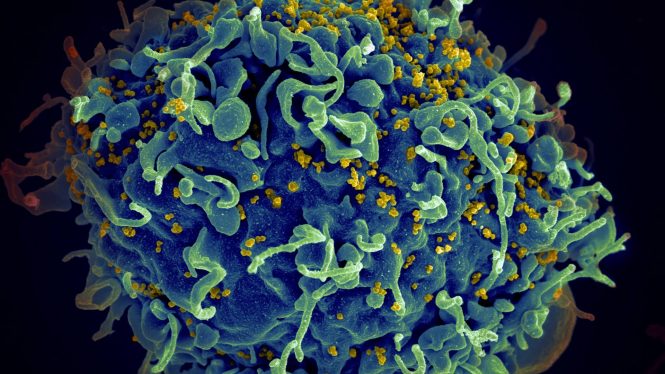 Una paciente de Barcelona lleva quince años controlando el VIH sin tomar medicamentos