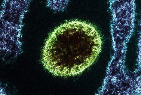 China identifica un nuevo virus zoonótico que ya cuenta con 35 infectados confirmados